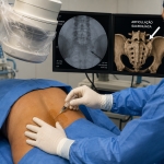 Bloqueio da articulação sacroilíaca guiado por fluoroscopia para tratamento da dor lombar.